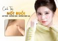 Cách tẩy nốt ruồi tại nhà