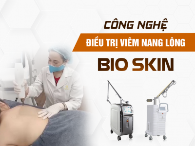 Điều Trị Viêm Nang Lông Bằng Laser