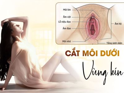 Cắt Môi Dưới Vùng Kín