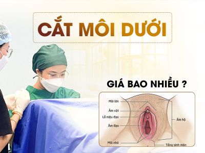 Cắt Môi Dưới Vùng Kín Giá Bao Nhiêu