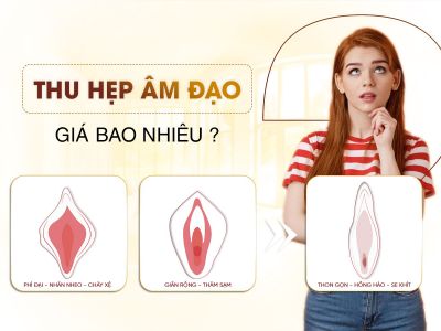 Thu Hẹp Âm Đạo Giá Bao Nhiêu