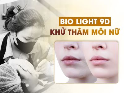 Khử Thâm Bio Light 9D Nữ