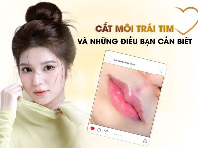 Cắt Môi Trái Tim Và Những Điều Bạn Cần Biết