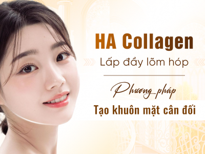 Tiêm HA Collagen Làm Đầy Má