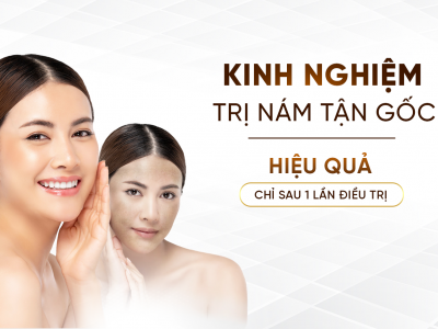 Điều Trị Nám Tận Gốc