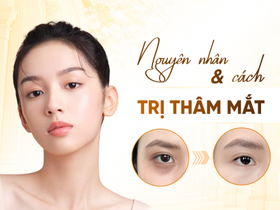 Cấy Tinh Chất Thâm Quầng Mắt 