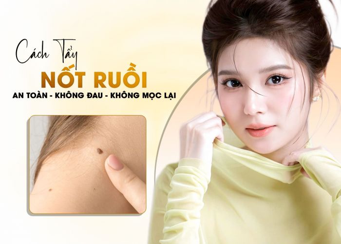 Cách tẩy nốt ruồi tại nhà