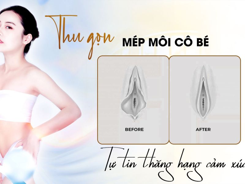 Thu Gọn Mép Môi Cô Bé