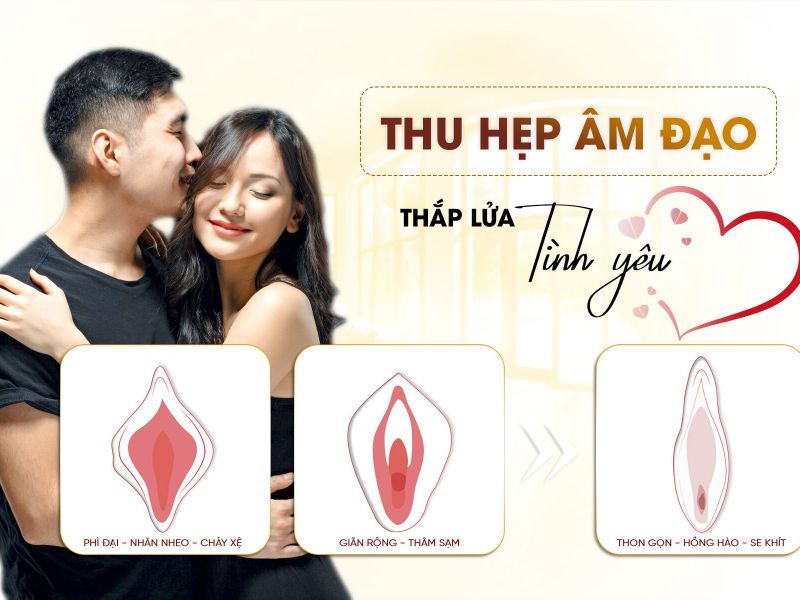 Thu Hẹp Âm Đạo 