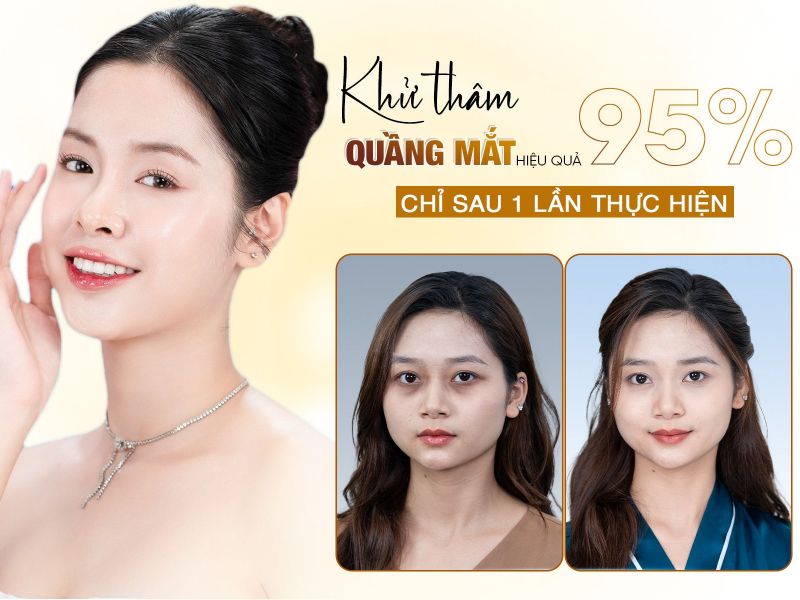 Cấy Tinh Chất Thâm Quầng Mắt Hàn