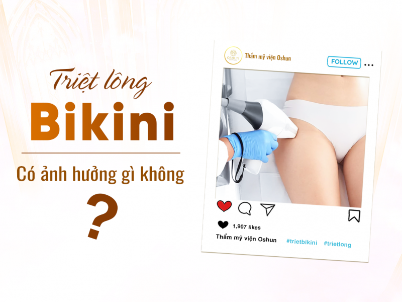 Triệt Lông Bikini Có Ảnh Hưởng Gì Không?