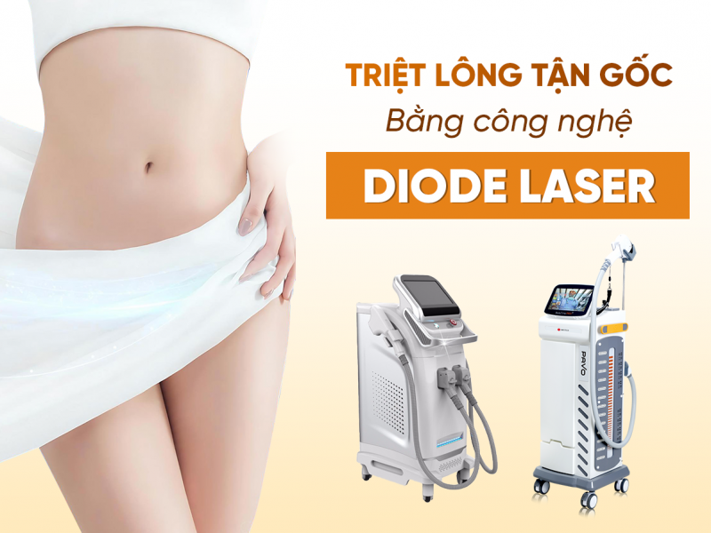 Triệt Lông Bằng Công Nghệ Diode Laser