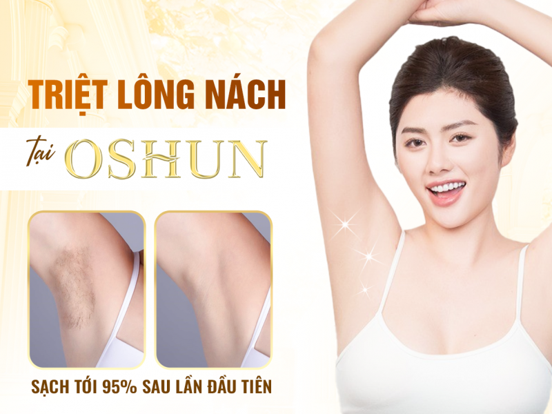 Triệt Lông Nách Tại Oshun