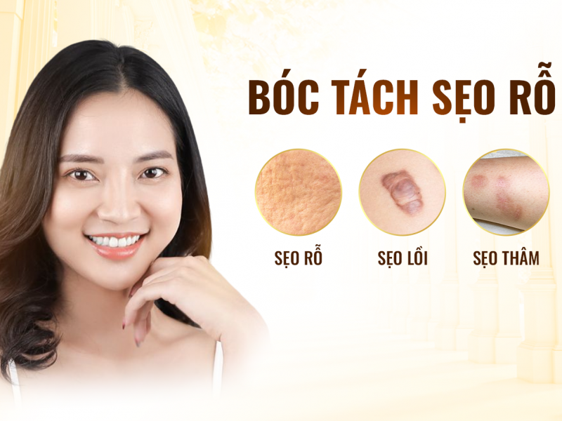 Bóc Tách Sẹo Rỗ Biên Hòa