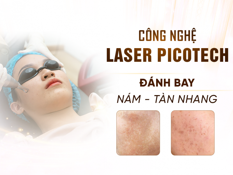 Laser Picotech Nám Tàn Nhang