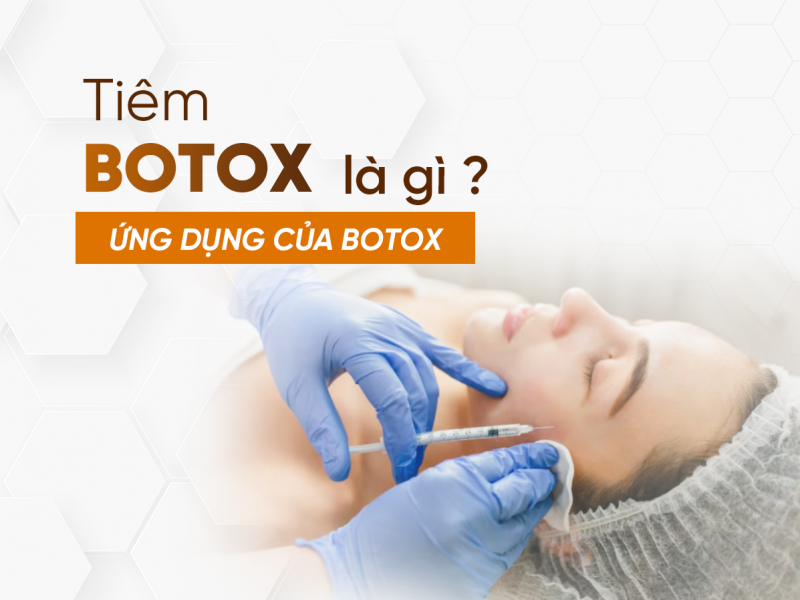 Tiêm Botox Là Gì? Ứng Dụng Của Tiêm Botox 